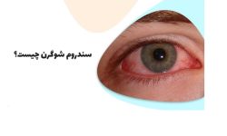 “شوگرن” دومین بیماری شایع روماتیسمی