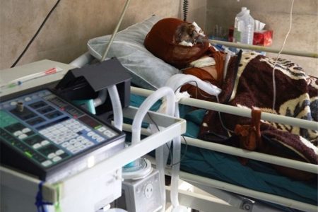 افزایش ۶۰ درصدی مرگ‌ومیر ناشی از سوختگی در همدان