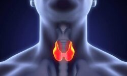 باور غلط درباره تیروئید؛ کم‌کاری تیروئید عامل اصلی چاقی نیست