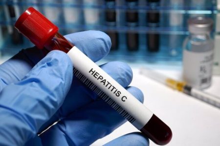 راه‌اندازی آزمایشگاه دولتی تشخیص مولکولی هپاتیت در همدان