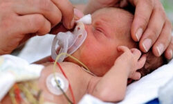 قریب به ۱۰ درصد از نوزادان همدان نارس هستند